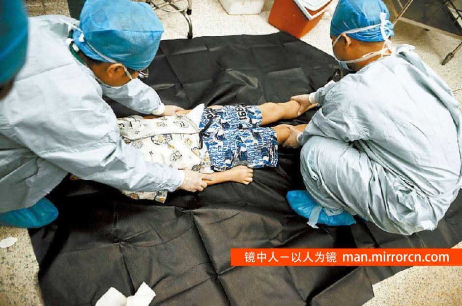 深圳11岁小学生身患脑瘤 临终前捐器官救人