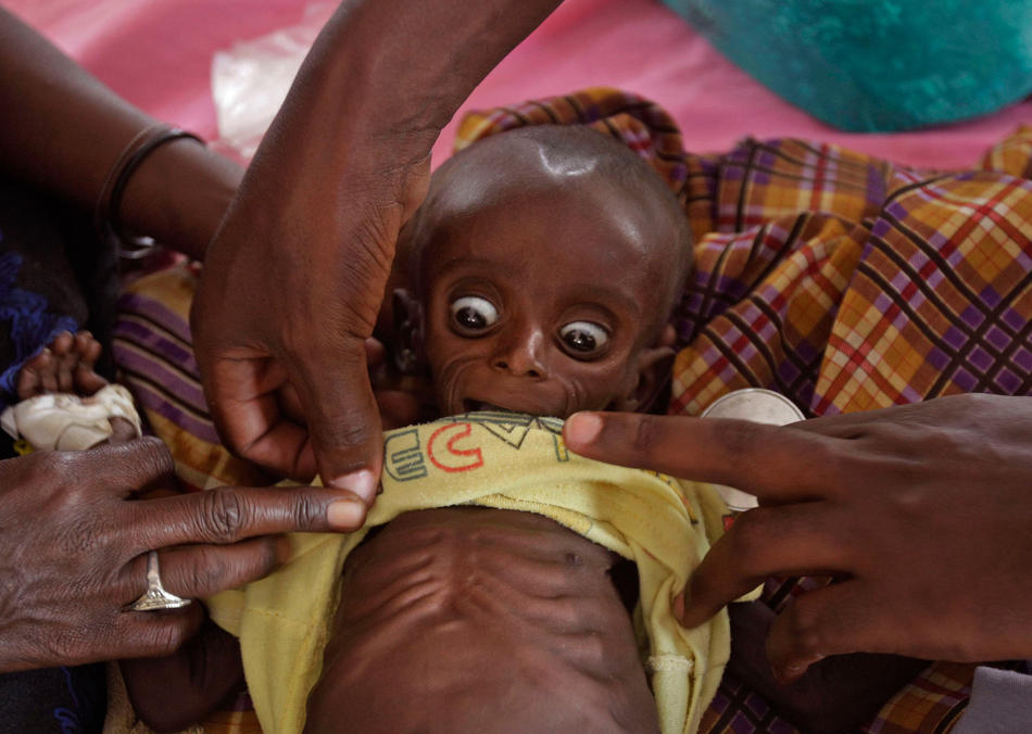 索马里的孩子